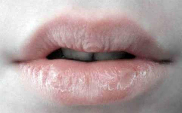 Trị Môi Thâm Khô