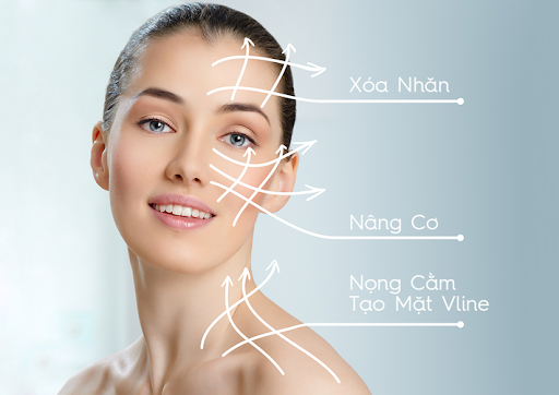 Nâng Cơ Xoá Nhăn 1 Lần Duy Nhất Không Phẫu Thuật